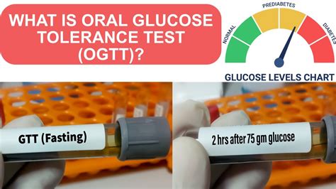 how hard is the ogt test|ogtt vs hba1c.